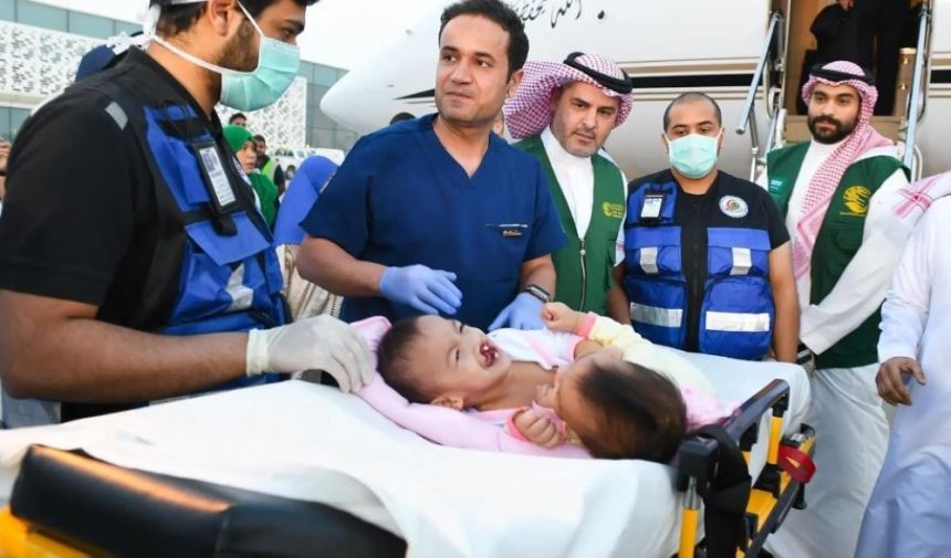 إجراء عملية فصل التوأمين الفلبينيين "عائشة وأكيزا".. الخميس المقبل