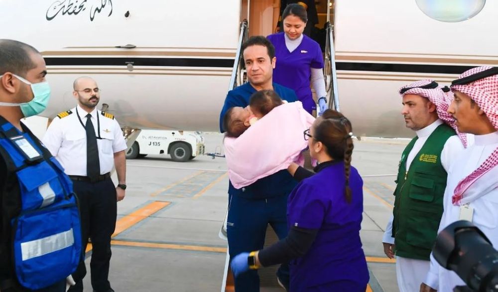 إجراء عملية فصل التوأمين الفلبينيين "عائشة وأكيزا".. الخميس المقبل