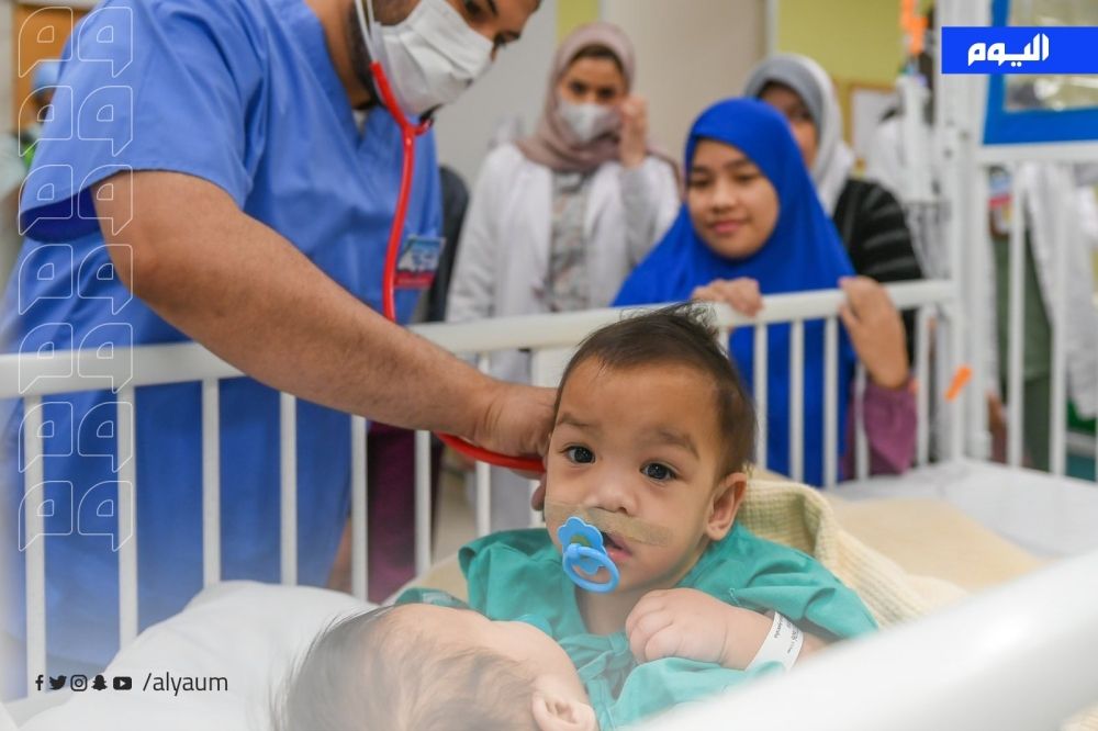 العملية رقم 61.. نجاح فصل التوأمين السياميين الفلبينيين "عائشة وأكيزا"