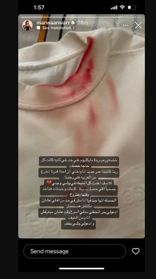 ربنا كتبلنا عمر جديد.. مروة أنور تنجو من حادث سير مروع