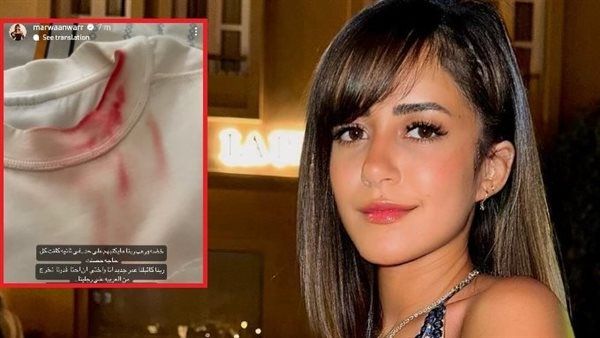 ربنا كتبلنا عمر جديد.. مروة أنور تنجو من حادث سير مروع
