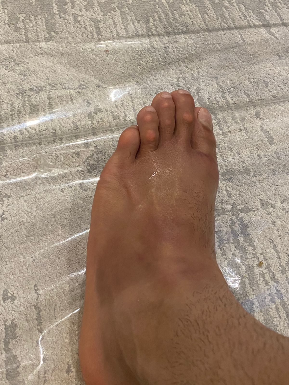 تجدد إصابة مهاب ياسر فى الزمالك.. صور