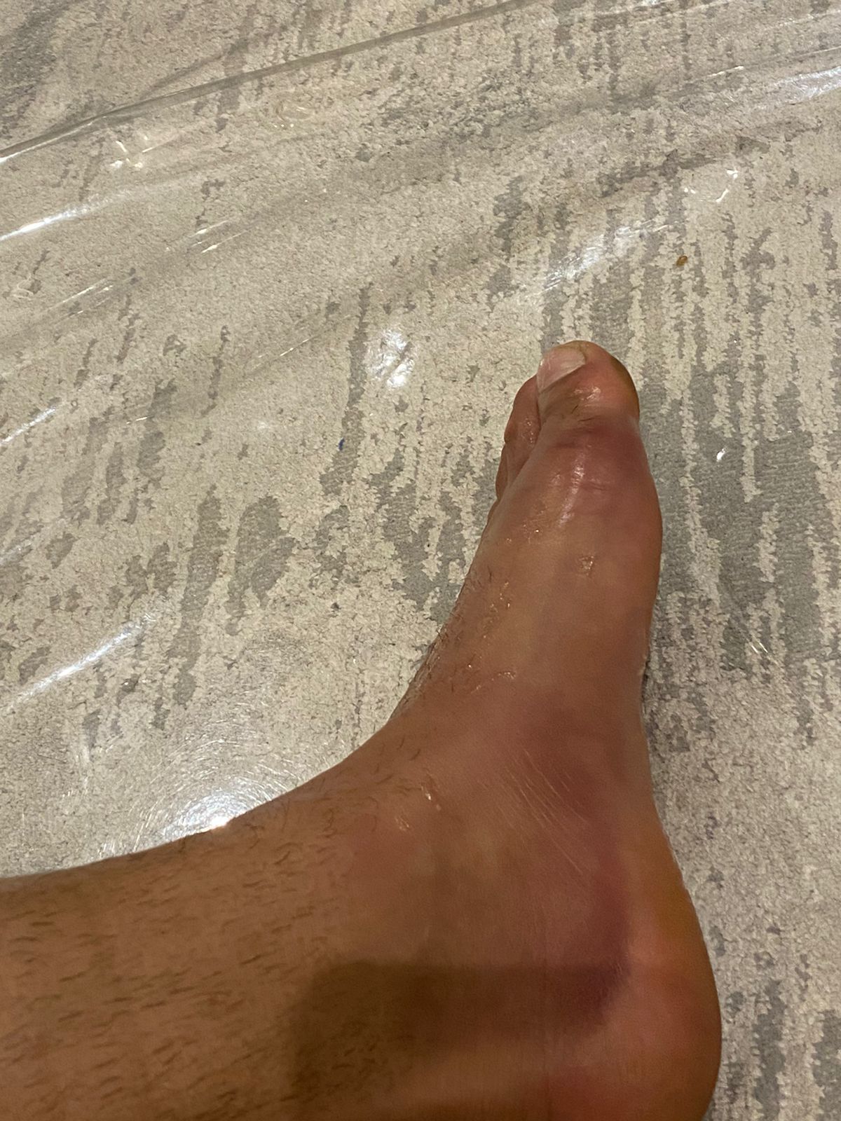 تجدد إصابة مهاب ياسر فى الزمالك.. صور