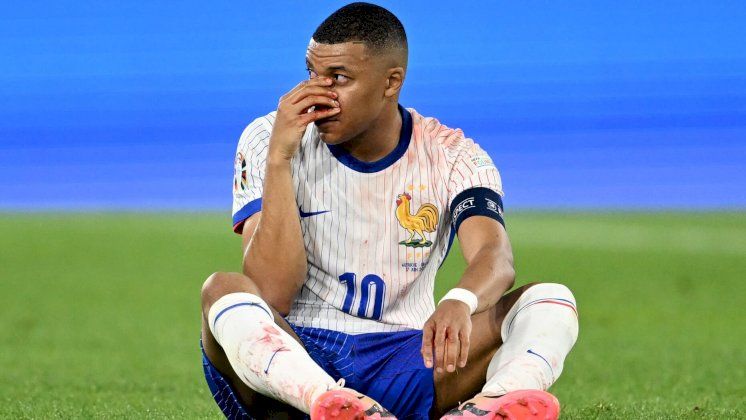 ما مصير كيليان مبابي بعد كسر أنفه؟