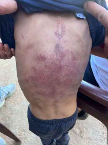 قوى الامن: توقيف سوري في سهل بلدة طاريا لاقدامه على قتل ابنته وتعنيف اطفاله