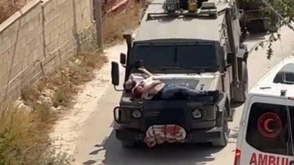 عزت الرشق: التنكيل بشاب فلسطيني جريح هو استمرارٌ لإجرام الجيش النازي