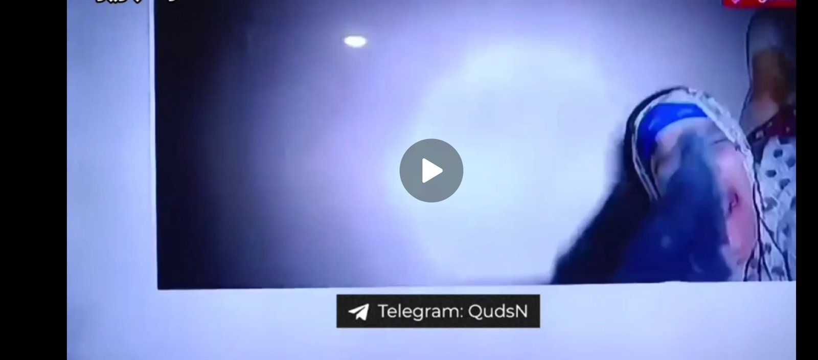 كلب الاحتلال يعتدي على مسنة فلسطينية رفضت ترك منزلها ويصيبها بكسور ونزيف