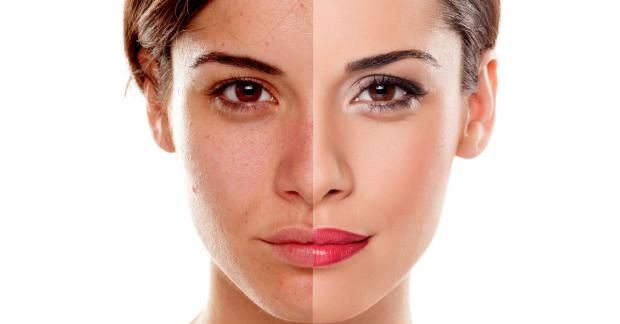 ماسك الطحينة لتنظيف البشرة والقضاء على الحبوب.. مش هتحتاجي لمستحضرات تجميل