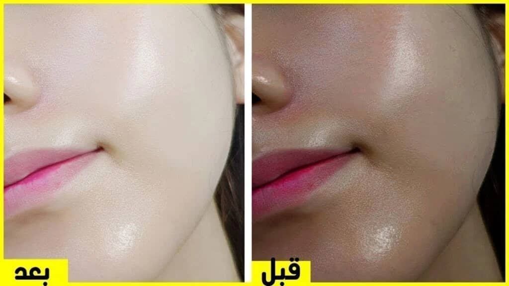 الوصفة السحرية وخلي أصحابك يغيروا منك” .. ب 3 مكونات بس هتخلي بشرتك زي بياض التلج وهتدعي لي