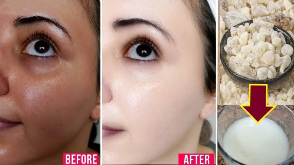 وصفة لبان الذكر لتفتيح البشرة هتخليكي تغيري مفهومك عن الوصفات الطبيعية وتعرفي فائدتها بجد