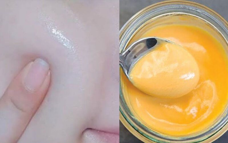 إليك تجربتي.. دلكة الكركم والنشا لتبيض الجسم من أول يوم بياض الثلج وإزالة بقع وسواد سنين