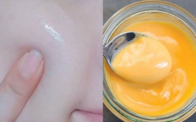 قنبلة التفتيح.. كريم النشا والليمون لتبييض البشرة والجسم كله والأماكن الداكنة وعلاج حب الشباب!