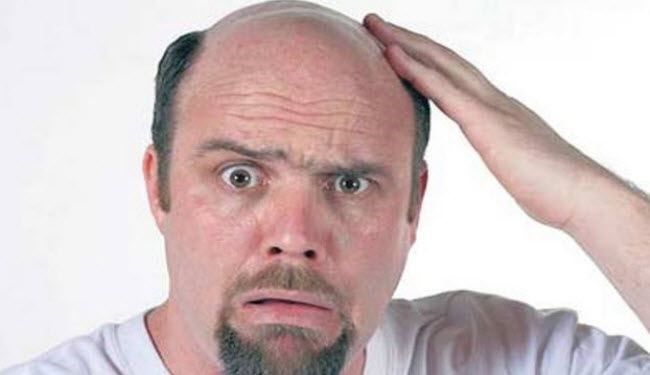 هل السكر الطبيعي يساعد على علاج الصلع لدى الرجال؟