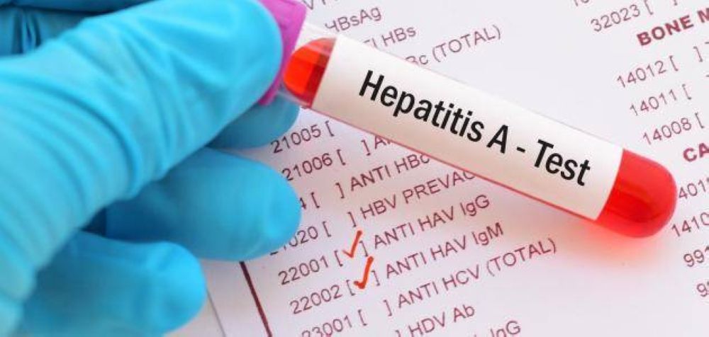 منع زواج وعمل المصابين بفيروس الكبد.. لحين اكتمال الشفاء