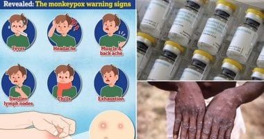 وزارة الصحة تكشف معلومات هامة عن فيروس جدرى القرود.. اعرف التفاصيل