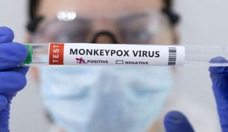 باكستان تسجل أول حالة إصابة بفيروس جدري القردة