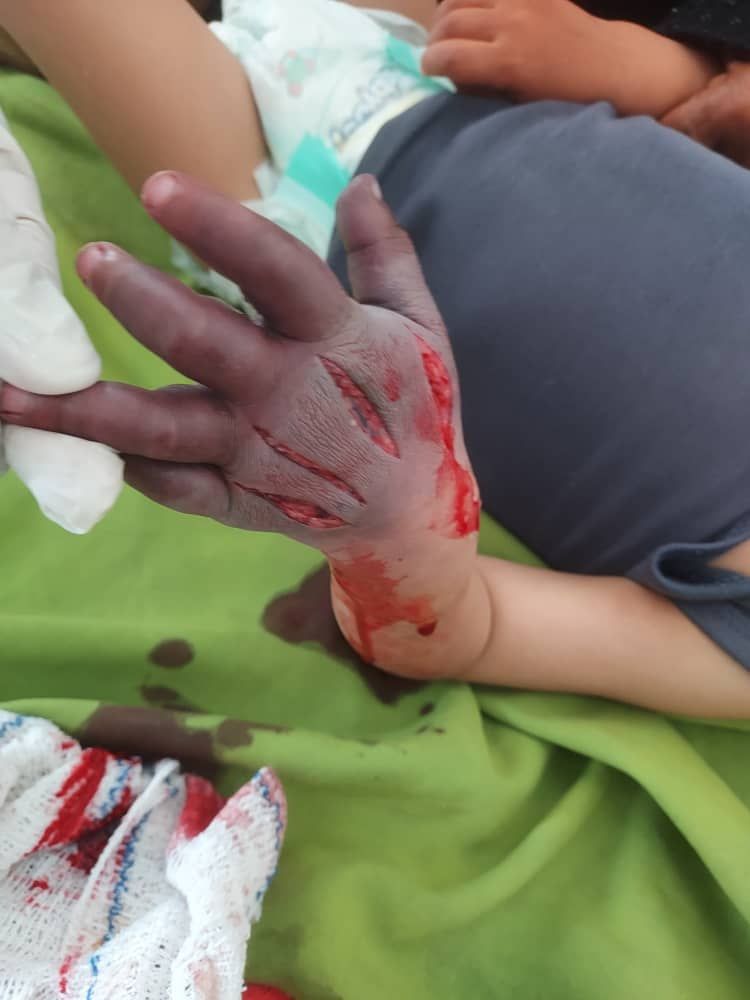 جريمه في عزله وتير جبل صبر محافظه تعز