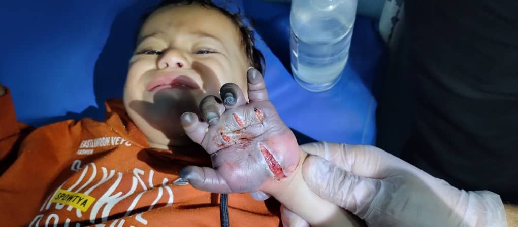 جريمه في عزله وتير جبل صبر محافظه تعز