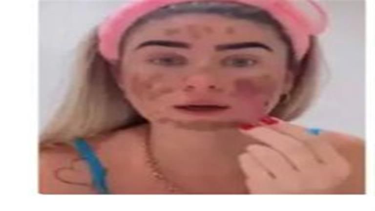 عارضة أزياء تضع "أغرب قناع" على وجهها: "سمعت أنه يمنع الشيخوخة" (فيديو)