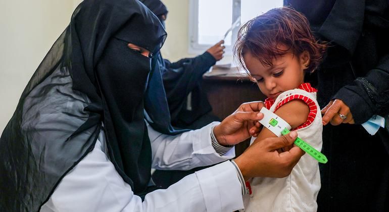 الخليج اليوم .. اليونيسف: 48% من أطفال اليمن يعانون من التقزم