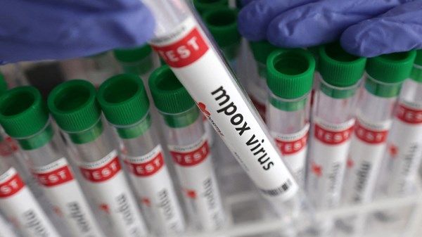 سنغافورة سجلت 13 حالة إصابة بجدري القردة