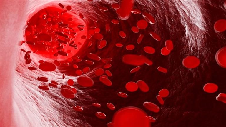 6 علامات تشير إلى الإصابة بالأنيميا الحادة.. اكتشفها قبل فوات الأوان