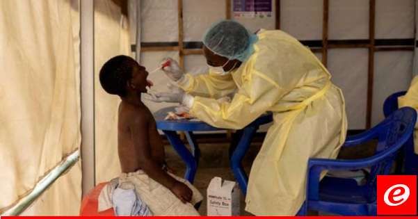 الصحة العالمية: يمكننا القضاء على جدري القردة بـ6 أشهر