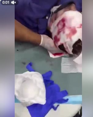 استشهاد ناشطة أمريكية بطلقة إسرائيلية في الرأس جنوب نابلس