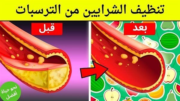ملـعقة تنظيف الشــرايين ستخرج من شراينك دهــون ملتـصقة ومتراكمة لم تخرج من سنوات وسينتعش قلــبك