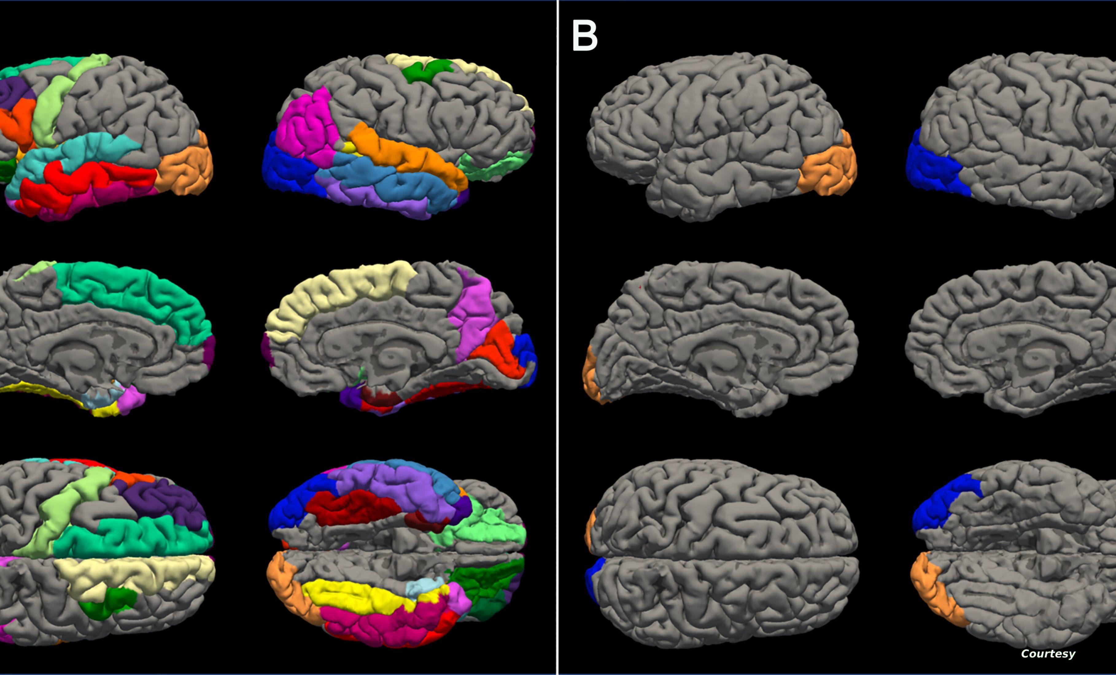 الامارات | دراسة: أدمغة المراهقين تقدمت في العمر بشكل أسرع خلال جائحة كورونا