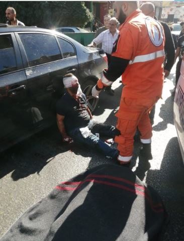 أكثر من 1000 شخص مصاب بسبب انفجار أجهزة "بيجر" فى لبنان.. صور