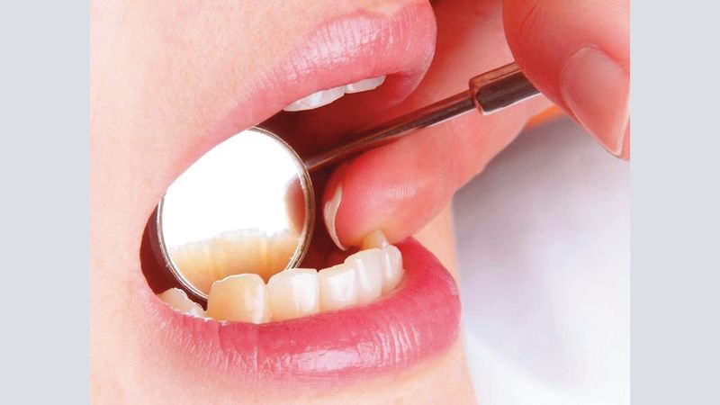 الامارات | أسباب نزف اللثة