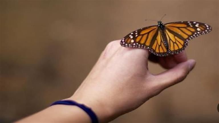 حالة نادرة.. 10 صور لطفل مولود بجلد الفراشة - وهذا ما حدث له