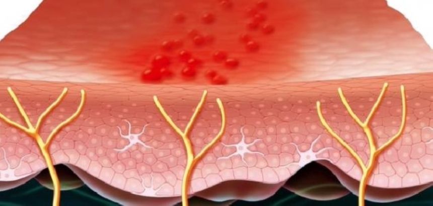 بمشاركة 25 متحدثًا.. انطلاق مؤتمر أمراض الدم الحميدة بالمدينة المنورة غدًا