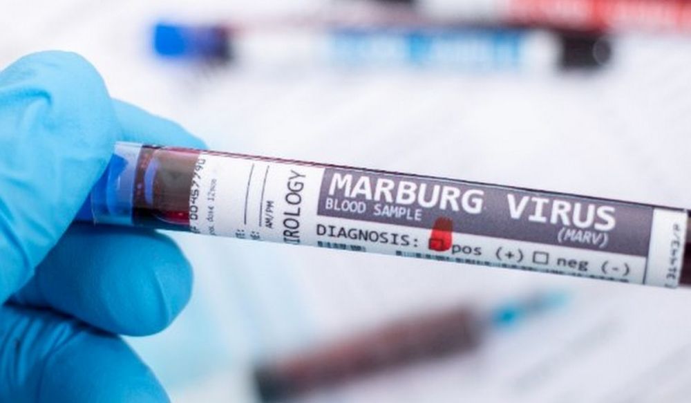 رواندا تسجل 6 وفيات بفيروس "ماربورج"