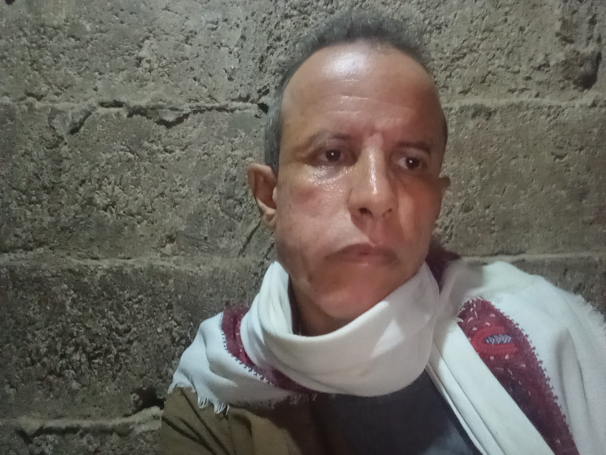 اليمن.. الإفراج عن الصحفي محمد الصهباني بعد 12 يوماً من الاختطاف في سجون الحوثيين