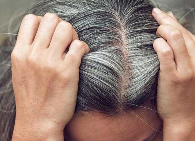 الامارات | دراسة توضح سبب الشيب قبل سن الثلاثين