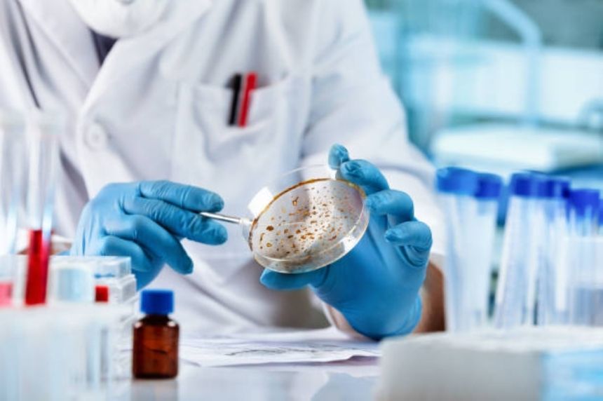 59 % سعوديون.. 41 ألف إصابة بأمراض معدية في المملكة خلال عام