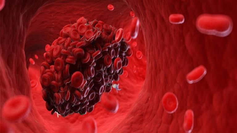 أطعمة تحارب الجلطات الدموية - تناولها فورا