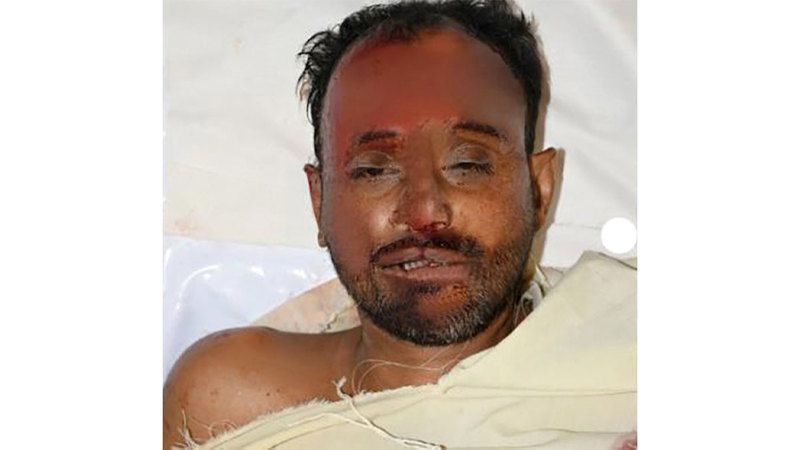 الامارات | شرطة دبي تدعو للتعرف إلى صاحب جثة مجهولة