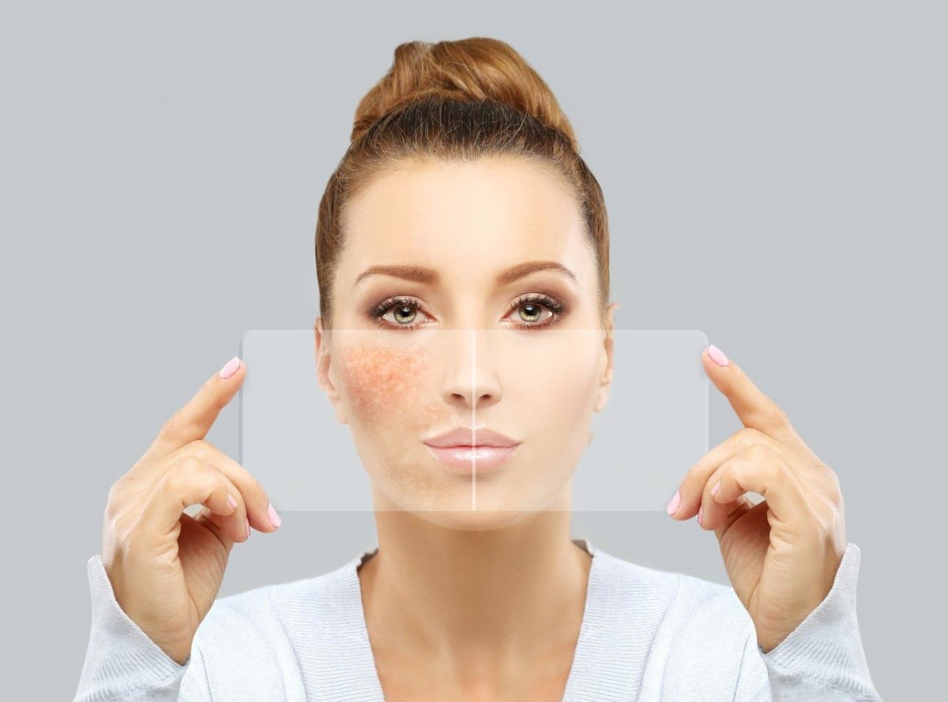 أسباب التصبغات في الوجه وأفضل الطرق للتخلص منها.. دليلك لبشرة نقية