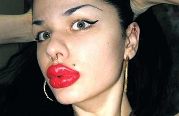 الامارات | العثور على جثة صاحبة أكبر شفاه في العالم