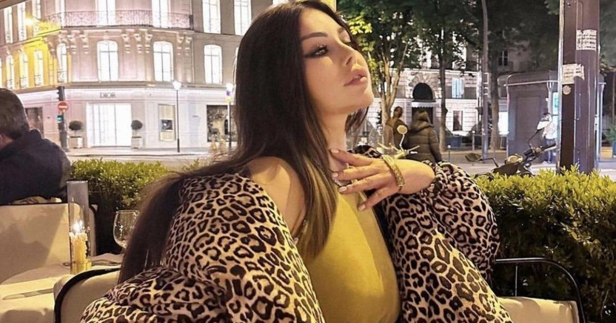 موضة "التايجر" لا تموت.. وهكذا اعتمدتها الفنانات