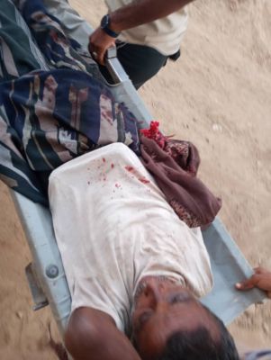 إصابة مواطن بقصف مدفعي لمليشيات الحوثي على الأحياء السكنية في حيس