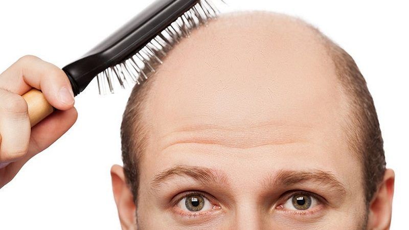 الامارات | عادة سيئة قد تؤدي إلى الصلع