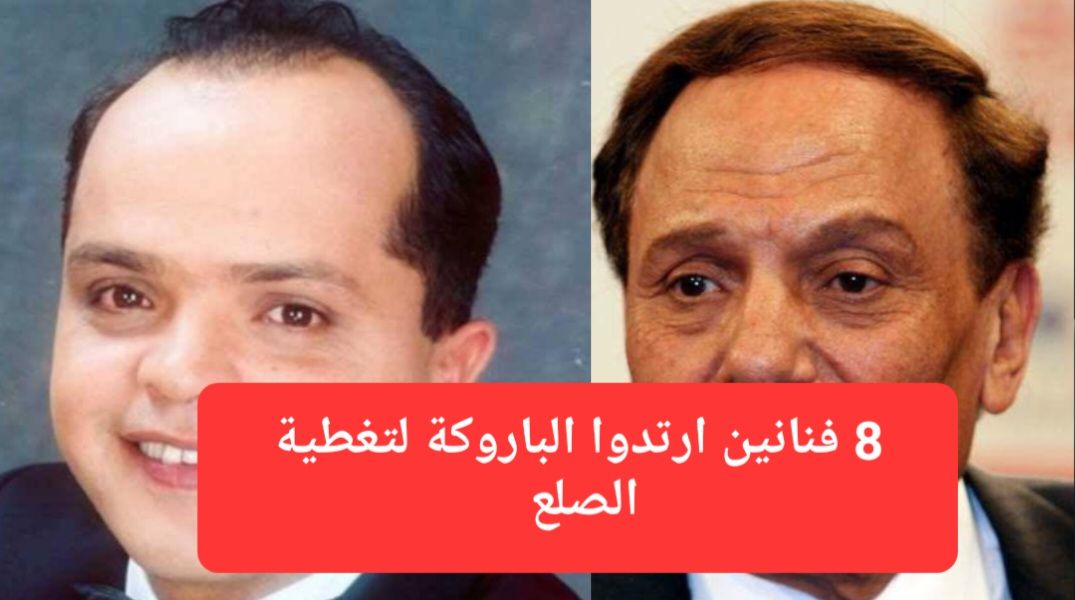 شاهد .. بينهم سعودي: 8 فنانين ارتدوا الباروكة لتغطية الصلع وخدعوا جمهورهم بالشعر الصناعي