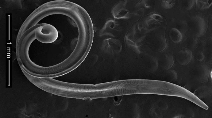 الامارات | ديدان حية تسكن عين امرأة