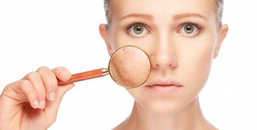 3 حيل لإبقاء بشرتك ناعمة في فصل الشتاء.. احرصي على نظام غذائي صحي