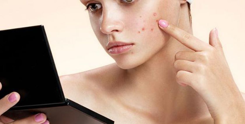 كيف تتخلصين من البثور الجلدية في خطوات بسيطة؟.. تجنبي هذا الفعل