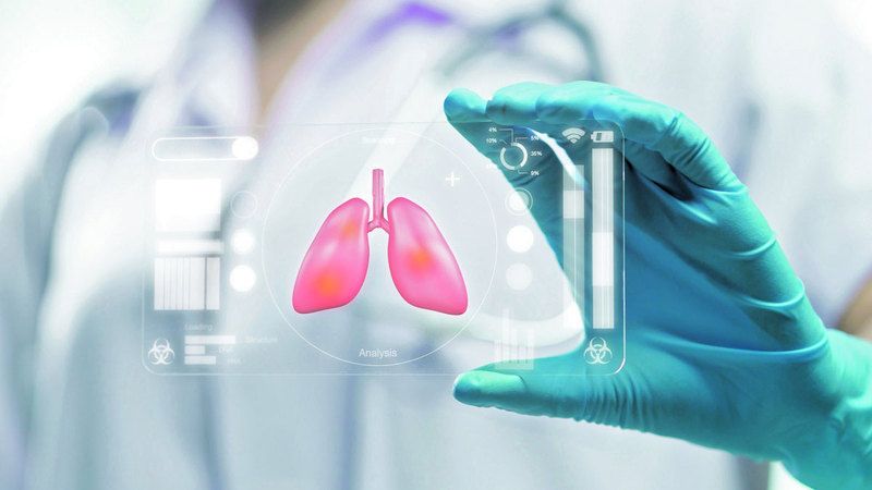 الامارات | 5 أسباب للإصابة بـ «التليف الرئوي»